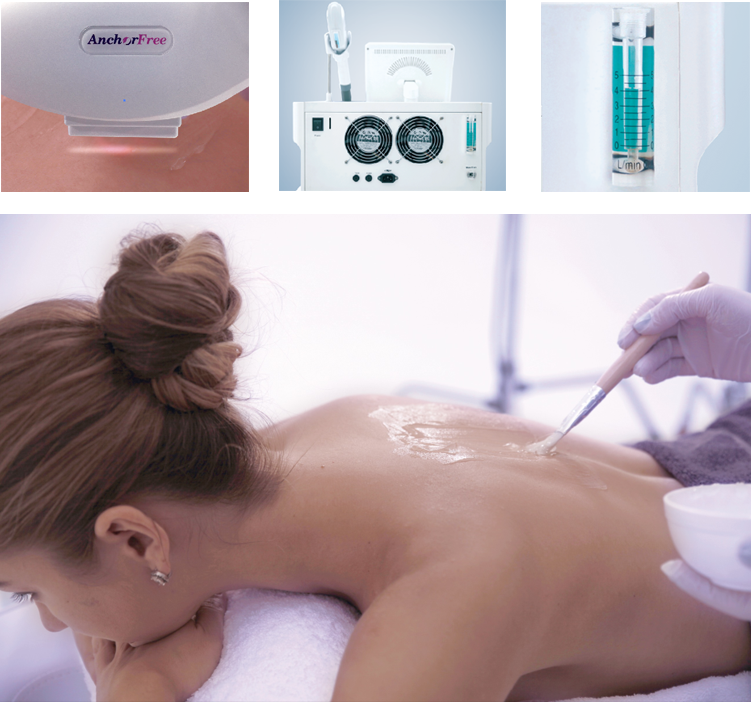 Anchorfree's hair removal machine in application
