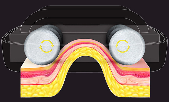 Mechanical roller massage: The synchronous rolling technology featured with eccentric cylinders and active motors provides a more effective and comfortable massage result.