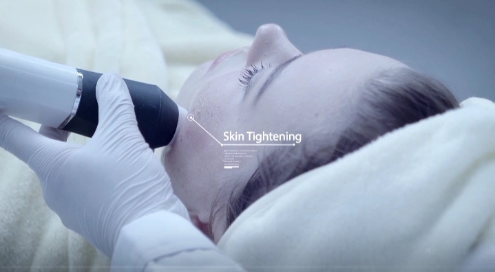 Techniques de gestion de la peau