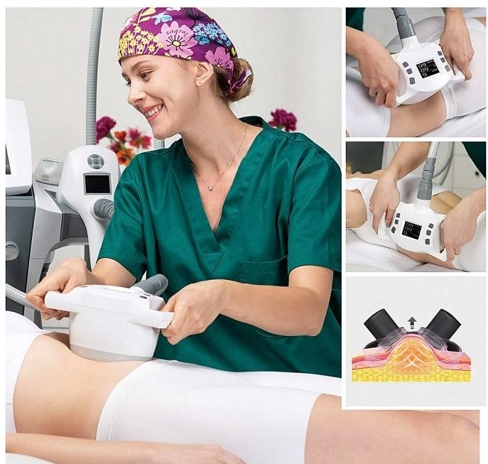 How Bipolar RF Boosts Skin Tightening and Body Contouring
