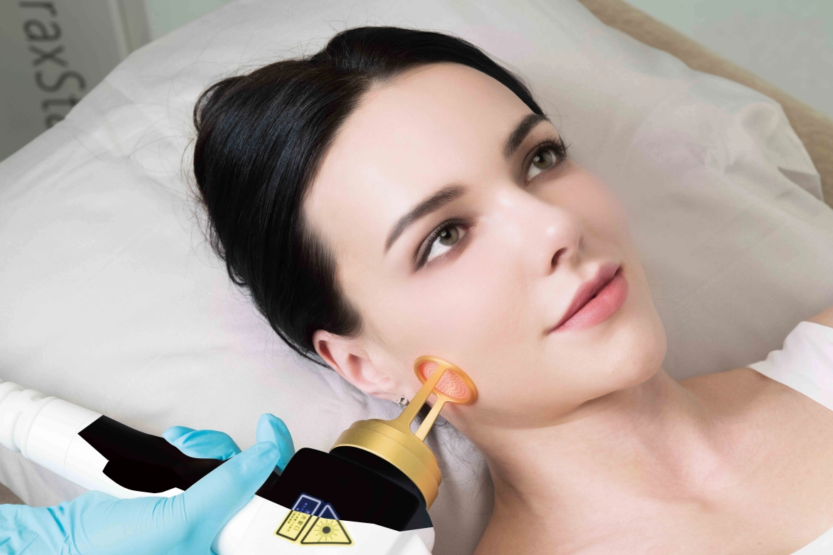 Laser à fibre Erbium 1550 nm pour l'élimination des cicatrices de varicelle