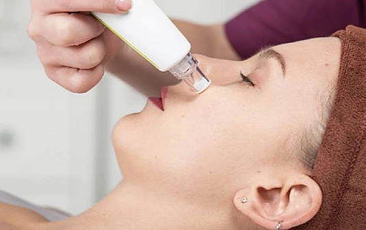 How Does a Facial Blackhead Removal Machine Work? Breaking Down the Pore Suction Process