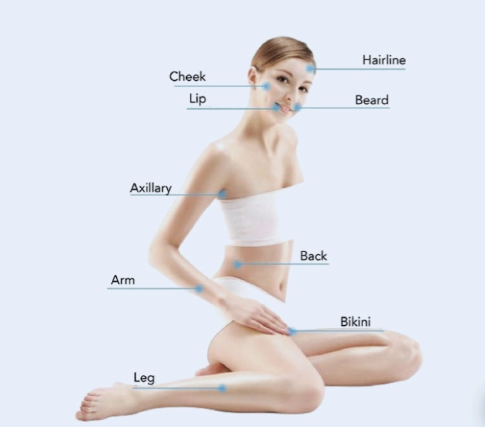 808nm Diode Laser Hair Removal