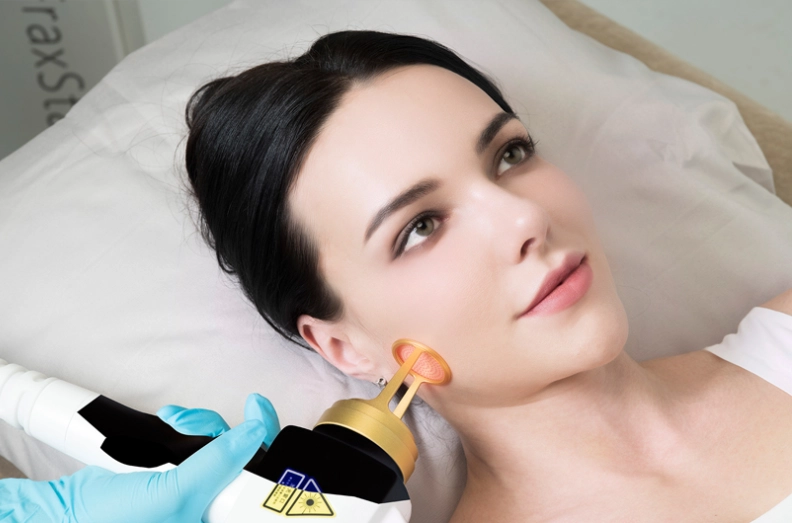 1550nm Erbium Fiber Fractional Laser Beauty Machine