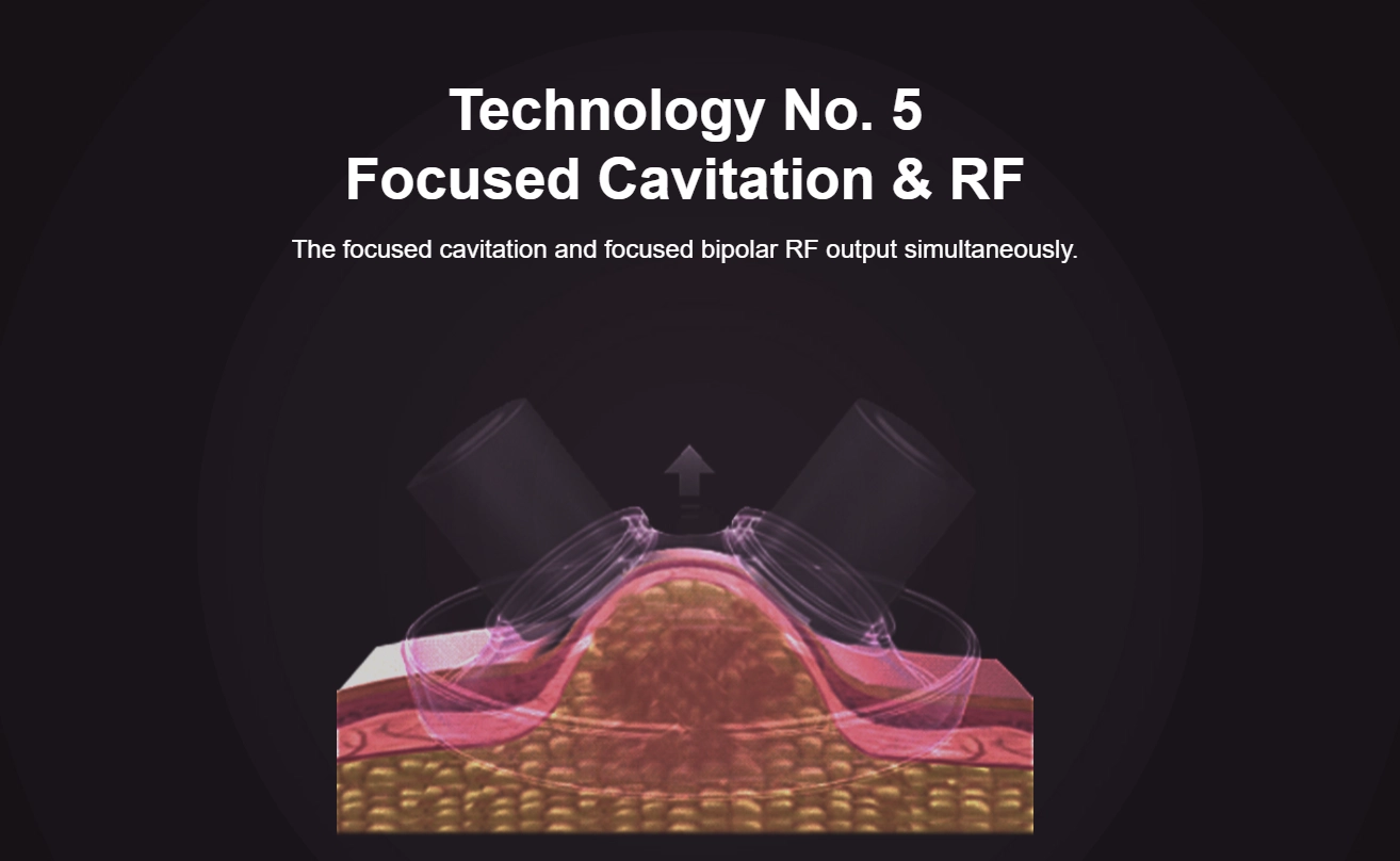 RF Cavitation device