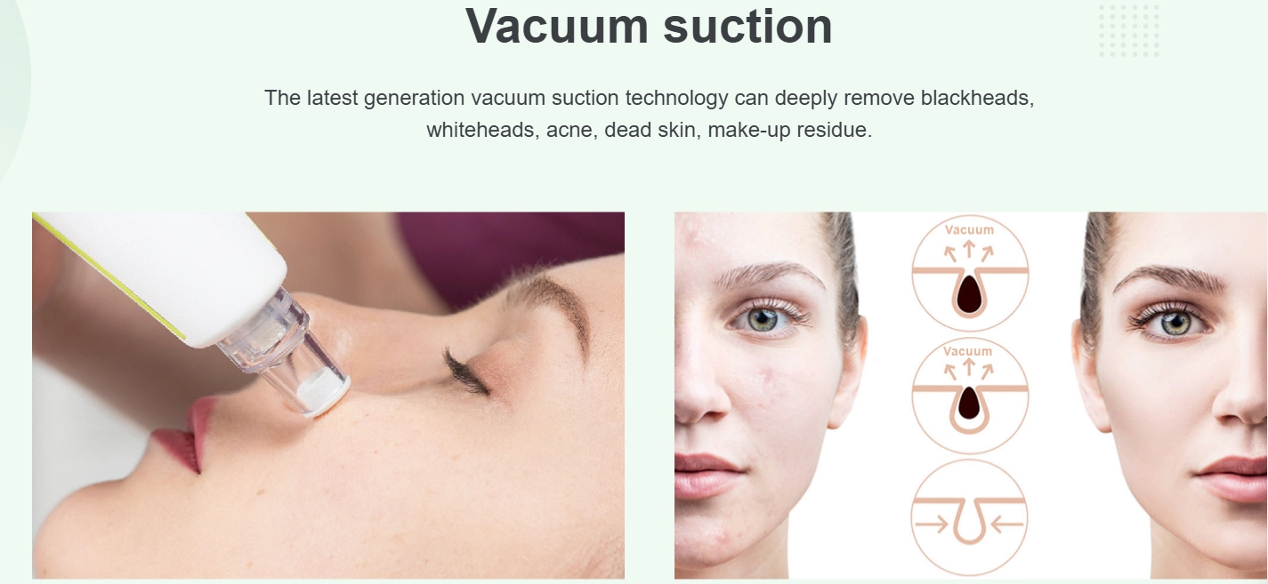 Blackhead Remover Vacuum Suction Device