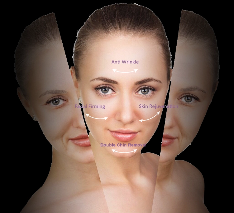 RF Treatment Help Reduce Wrinkles