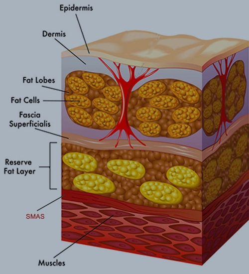 RF Treatment Help Reduce Wrinkles
