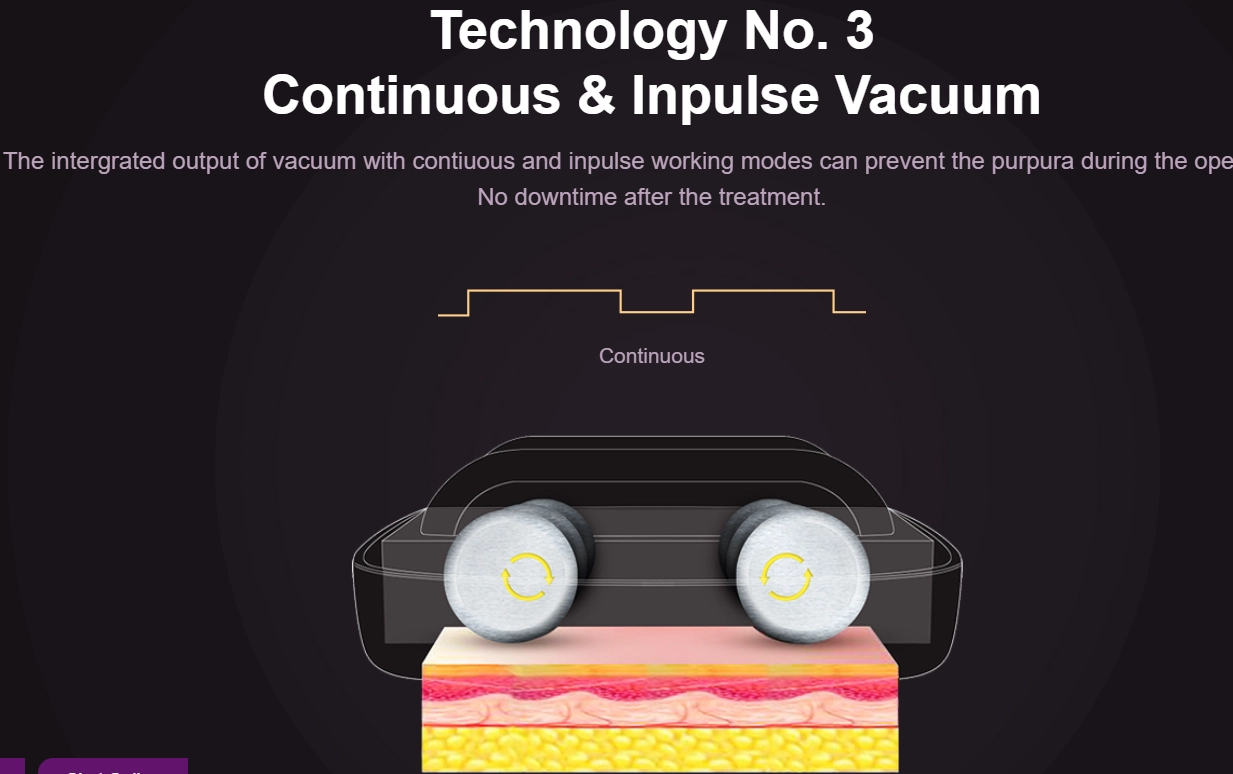 Slimming Vacuum Therapy3