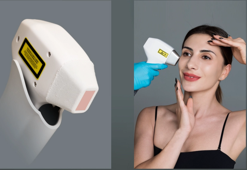 What is Diode Laser Hair Removal?
