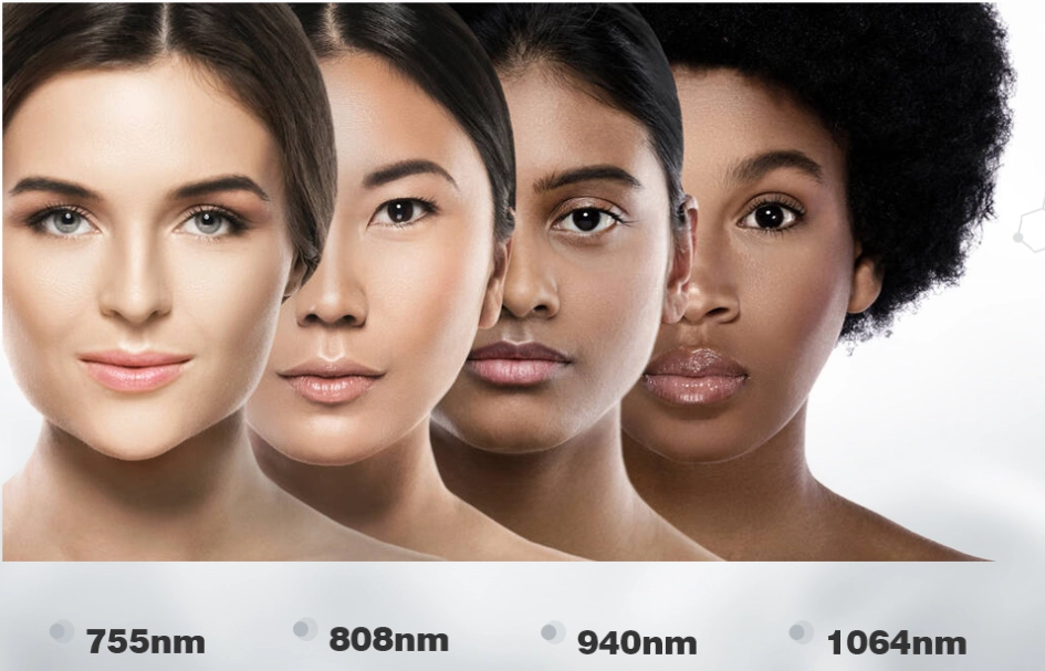 Diode Laser Hair Removal2