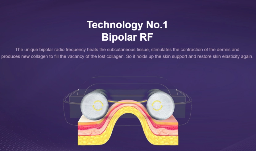 Radio Frequency RF Skin Tightening2