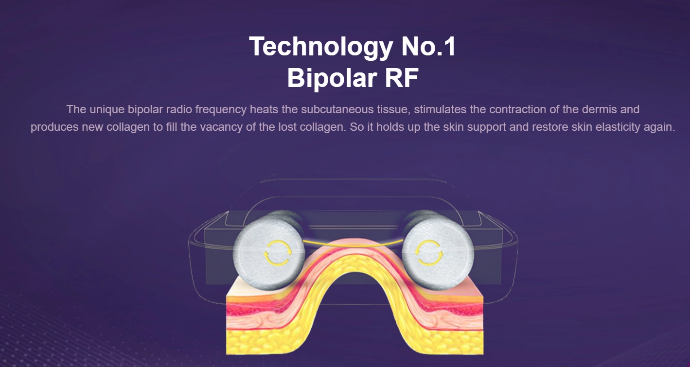 Bipolar RF for Skin Tightening and Cellulite Reduction