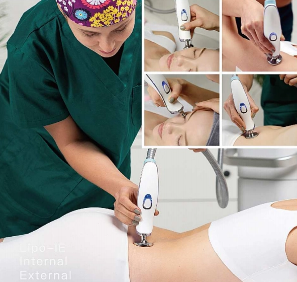 RF Skin Tightening machine on the face or body