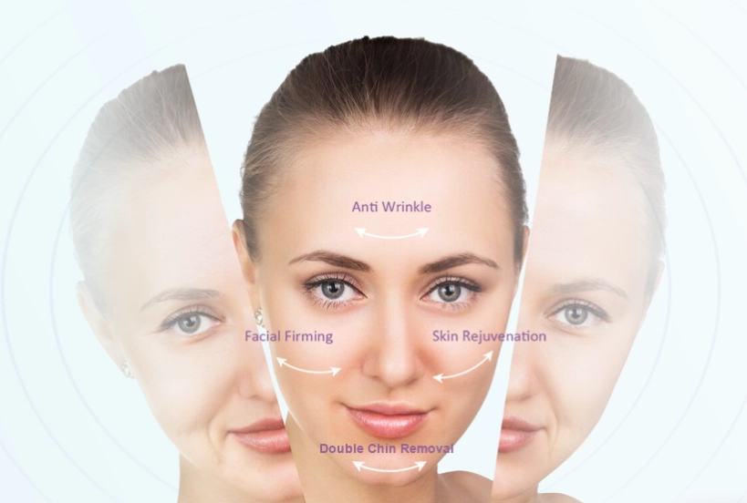 professional RF Lifting machine for sale manufacturer