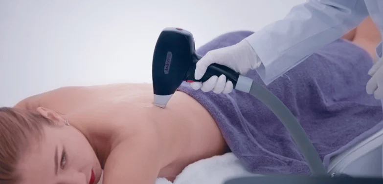 Laser hair removal