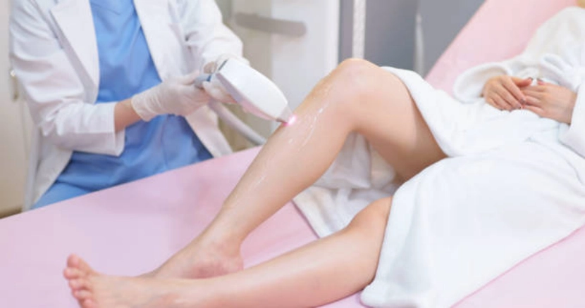 laser hair removal Treatment