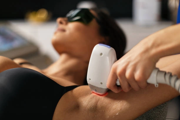 Laser Hair Removal Treatment